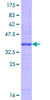 Human TIRC7 / TCIRG1 Protein (Recombinant GST, N-terminus)