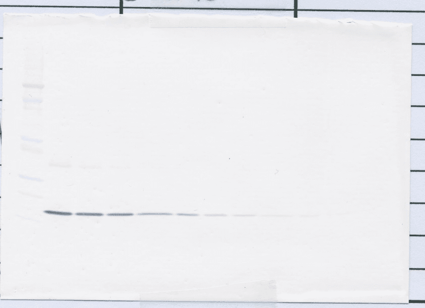 IL-1B / IL-1 Beta Antibody