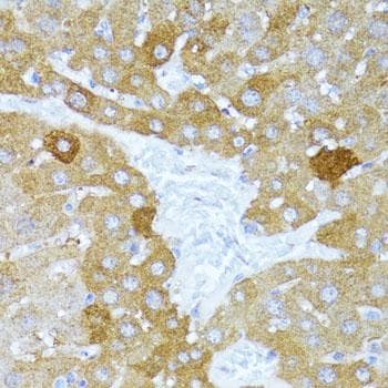 ULK1 Antibody