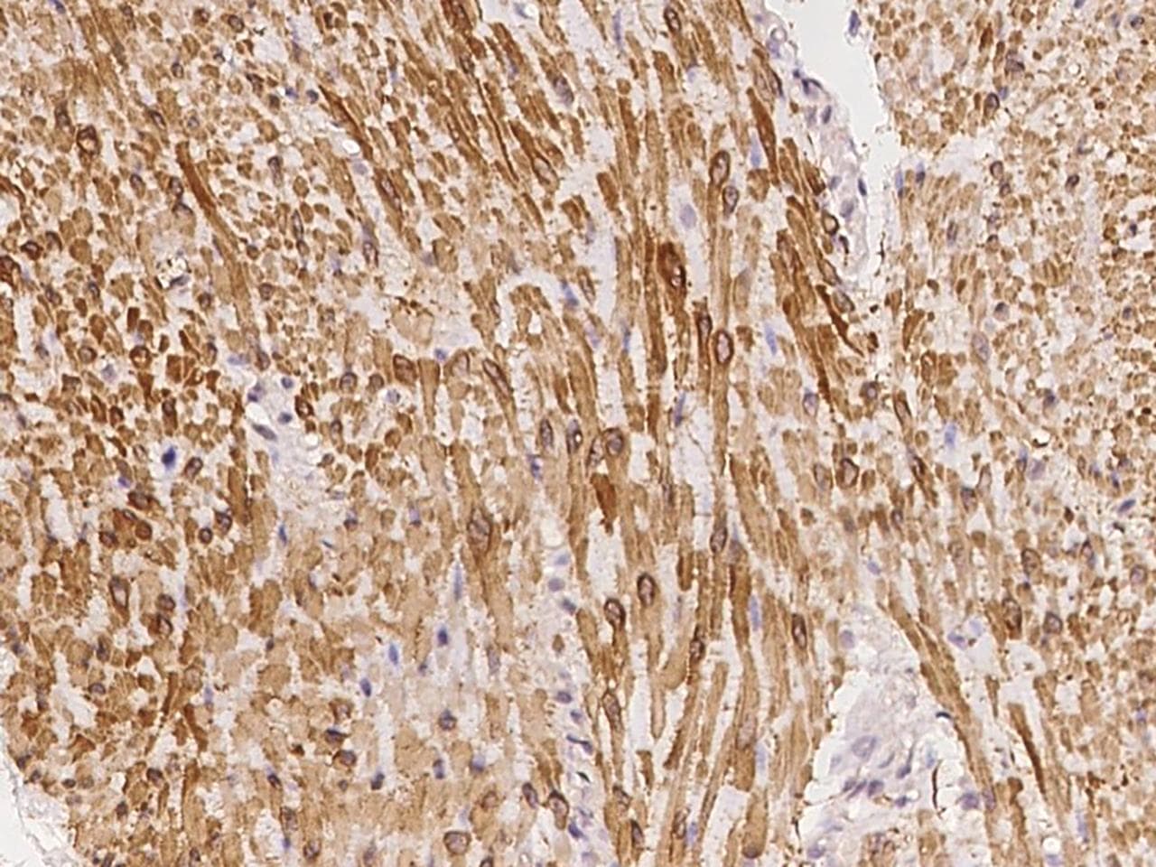 Polyclonal Rabbit anti-Human CNN1 / Calponin Antibody (IHC)