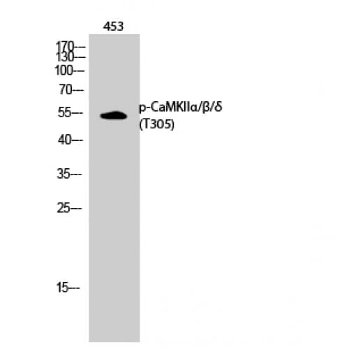 Polyclonal Rabbit anti-Human CaMKII Alpha+Beta+Delta Antibody (240-320 aa, IHC, WB)