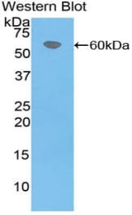 F7 / Factor VII Antibody (aa193-447, PE)