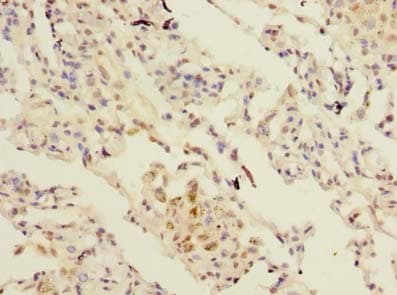SFTPC / Surfactant Protein C Antibody