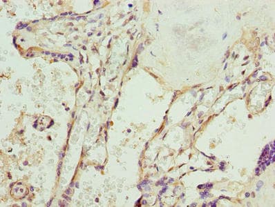 Polyclonal Rabbit anti-Human SPCS3 Antibody (IHC)