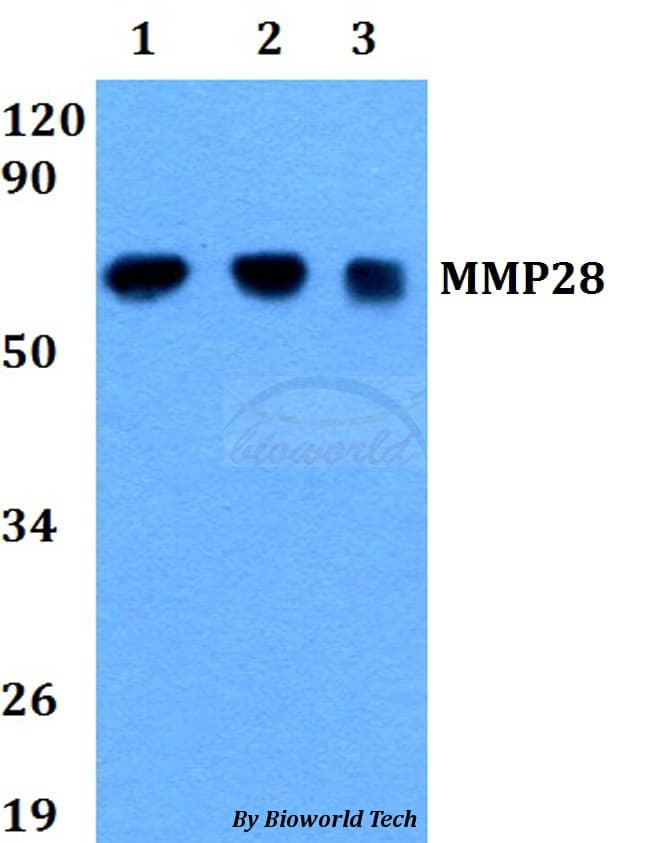 Polyclonal Rabbit anti-Human MMP28 Antibody (WB)