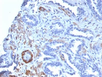 PathPlus™ SMMHC / MYH11 Antibody (clone MYH11/2303R)