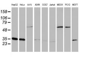 CYB5R3 / B5R Antibody (clone OTI1E8)