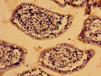 Polyclonal Rabbit anti-Human LIPA / Lysosomal Acid Lipase Antibody (aa28-372, IHC, WB)