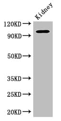 Polyclonal Rabbit anti-Human AAK1 Antibody (IHC, IF, WB)