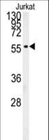 IHC-plus™ PLIN2 / ADFP / Adipophilin Antibody (aa186-214)