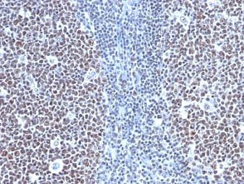Monoclonal Mouse anti-Human CCNB1 / Cyclin B1 Antibody (clone SPM619, IHC, IF)