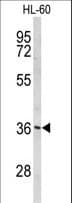 Polyclonal Rabbit anti-Human PEX14 Antibody (aa343-370, IHC, WB)