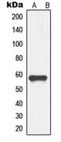 GDF9 / GDF-9 Antibody (Internal)