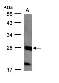 NTPCR / C1orf57 Antibody (aa127-190)