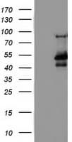 MTFMT Antibody (aa175-389, clone OTI1A10, Carrier-free)