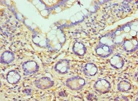 Polyclonal Rabbit anti-Human HYAL3 Antibody (aa198-417, IHC)