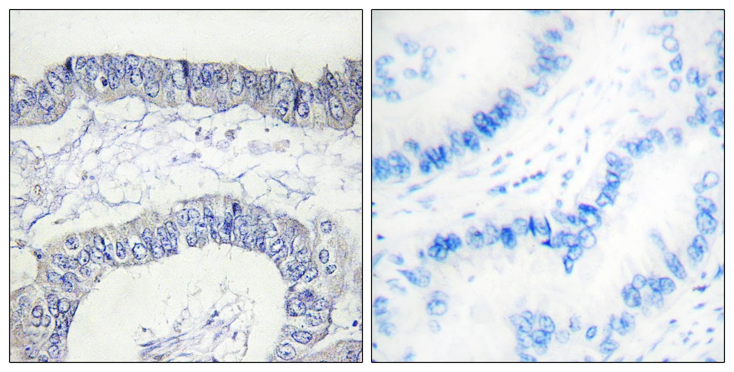 F12 / Factor XII Antibody (heavy chain, Cleaved-Ile20)