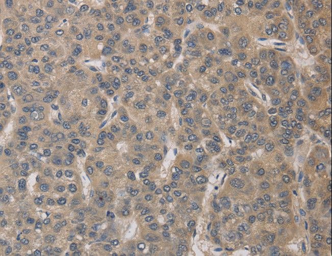 ELOVL1 Antibody