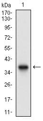 PathPlus™ ACP5 / TRAP Antibody (aa221-325, clone 5C5E7)