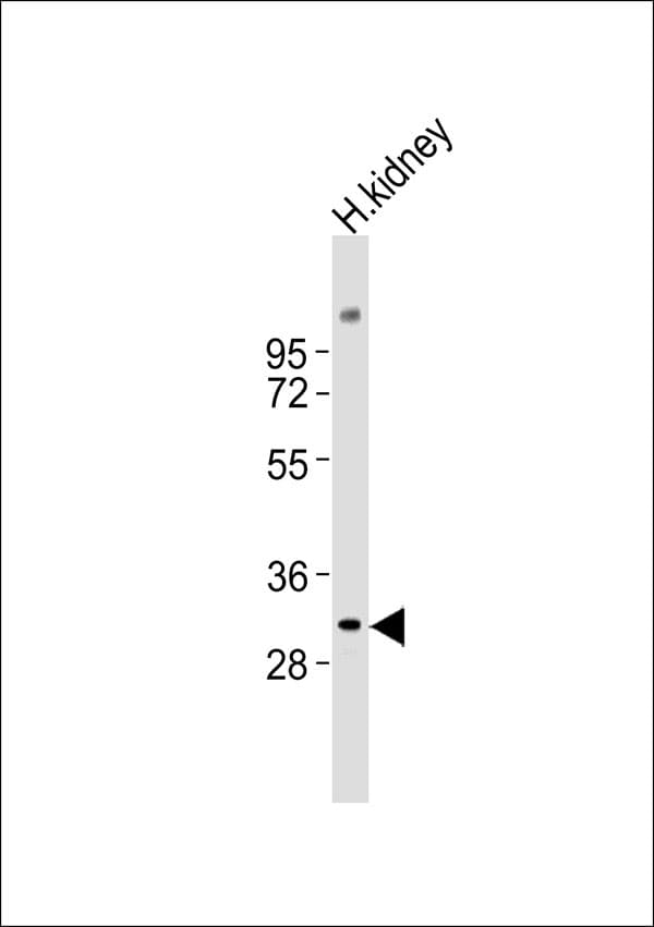 Polyclonal Rabbit anti-Human NXPH2 Antibody (WB)
