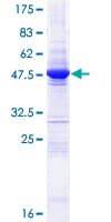 Human OVCA2 Protein (Recombinant GST)