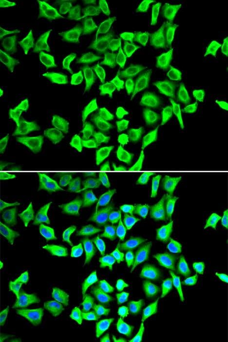 TP53 / p53 Antibody
