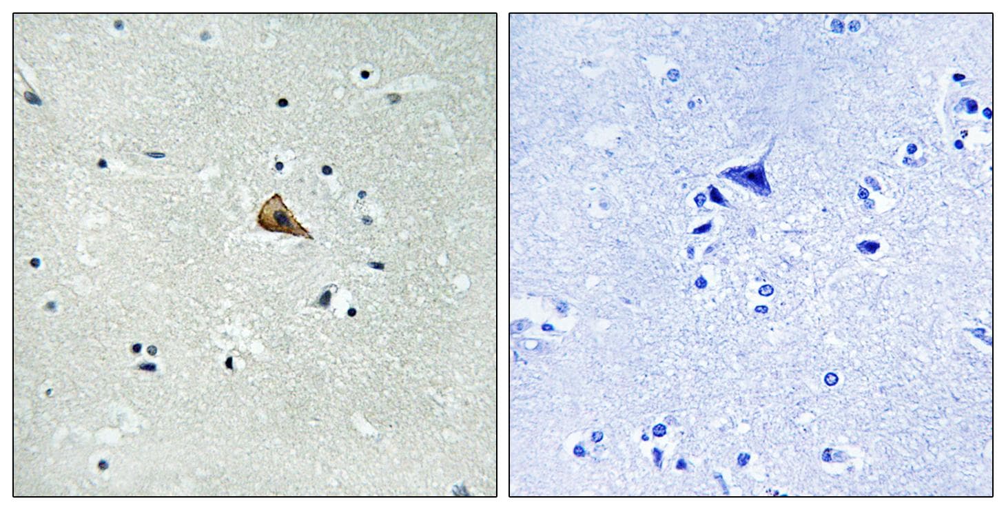 NTRK1 / TrkA Antibody (phospho-Tyr701)