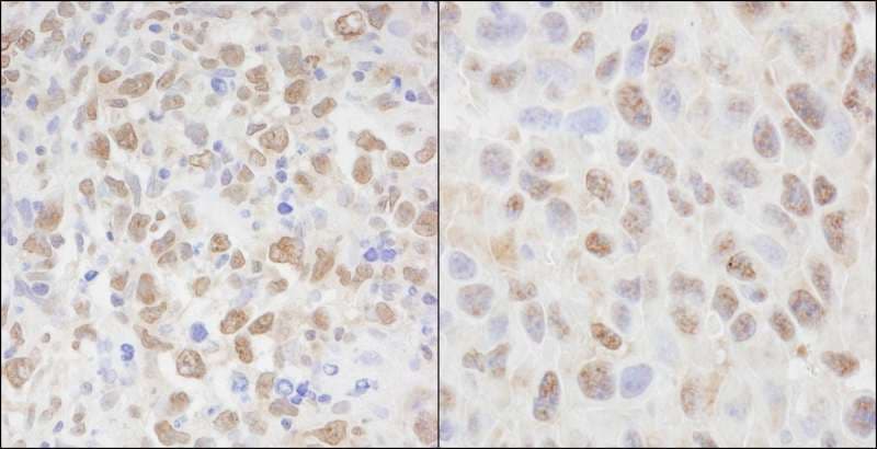 CSE1L Antibody (aa1-50)