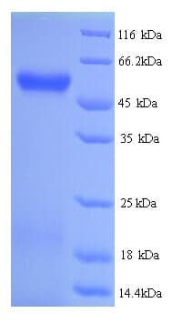 Human HYAL2 Protein (Recombinant His)