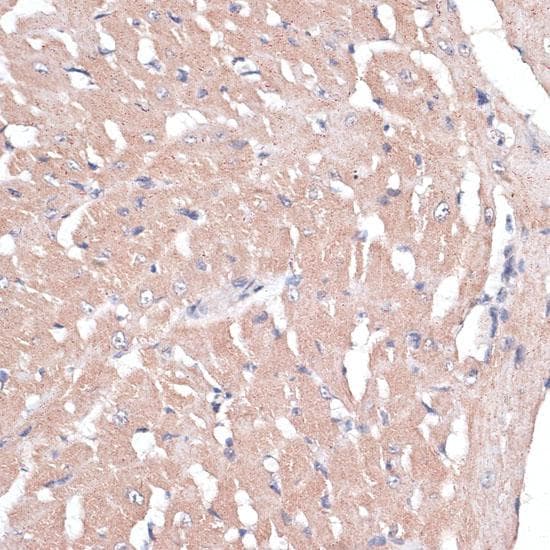 COL11A1 / Collagen XI Alpha 1 Antibody