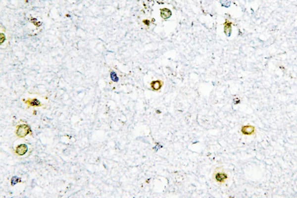 Polyclonal Rabbit anti-Human TRIM24 / TIF1 Antibody (Gln1034, IHC, WB)
