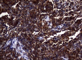 DOCK8 Antibody (aa84-405, clone OTI7H2)