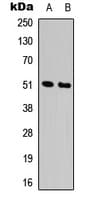 ADRA1A Antibody (Internal)