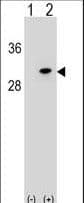 Polyclonal Rabbit anti-Human RPB16 / POLR2D Antibody (aa51-79, WB)