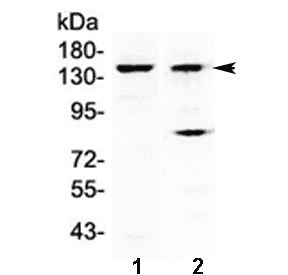 JHDM1A / KDM2A Antibody
