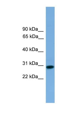 Polyclonal Rabbit anti-Human RCAN2 / RCN2 Antibody (aa71-120, WB)