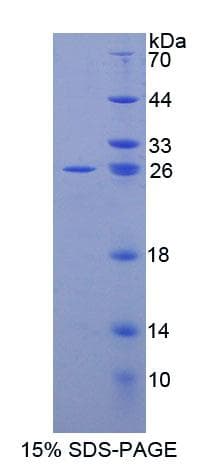 Mouse ABCD2 / ALDR Protein (Recombinant His-T7, N-terminus)
