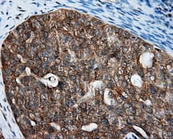 RIP1 / RALBP1 Antibody (clone OTI6E8)