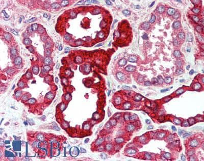 IHC-plus™ SLC8A1 / NCX1 Antibody