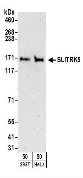 SLITRK5 Antibody (aa875-925)