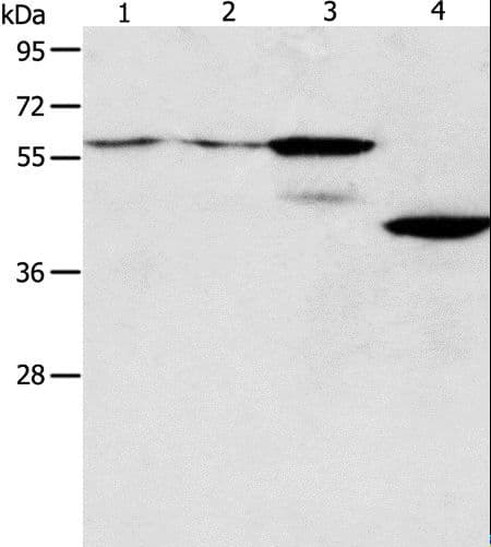 Polyclonal Rabbit anti-Human PGBD2 Antibody (WB)