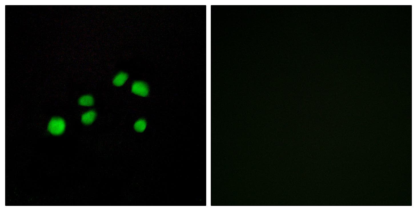 COL23A1 / Collagen XXIII Antibody