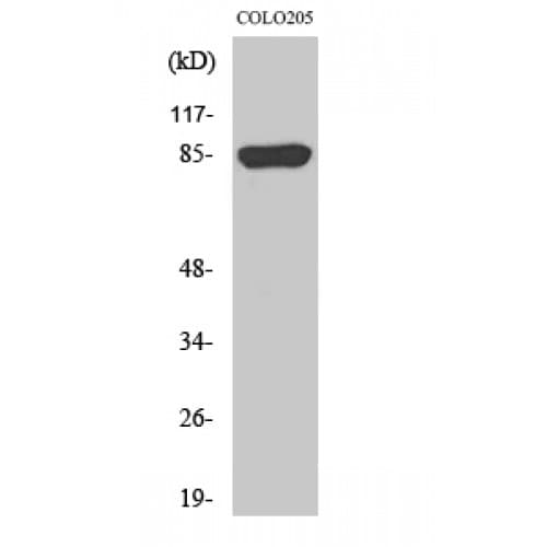CHML Antibody (100-180 aa, Internal)