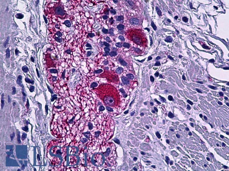 IHC-plus™ DPYSL2 / CRMP2 Antibody (aa480-529)