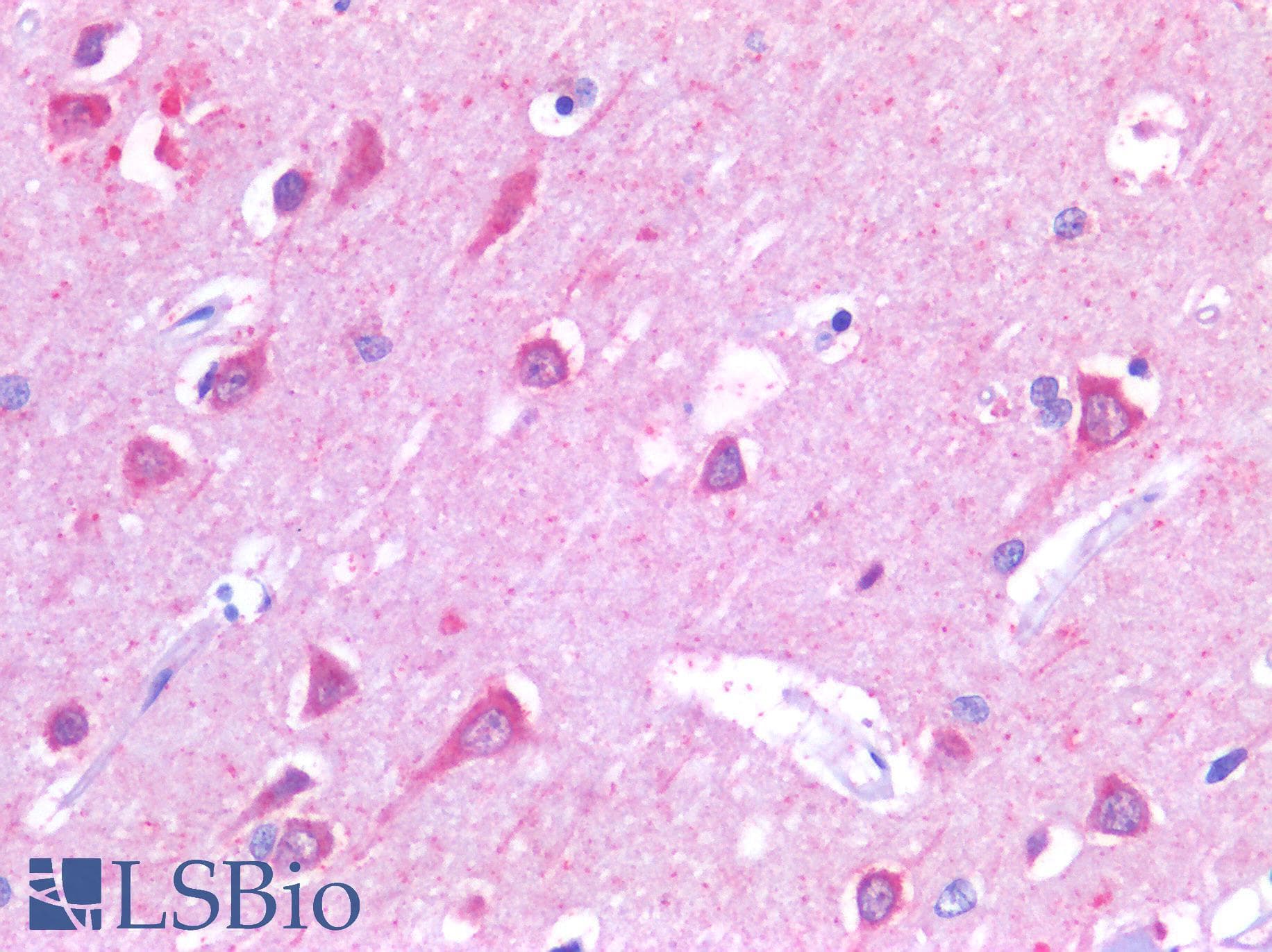 IHC-plus™ Polyclonal Goat anti-Human ANK3 / ANKYRIN-G Antibody (aa1690-1701, IHC)