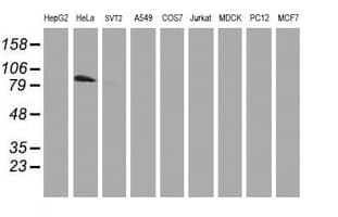 PFKP Antibody (clone OTI3H8)