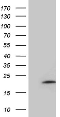 MMGT1 Antibody (clone OTI4D7, Carrier-free)