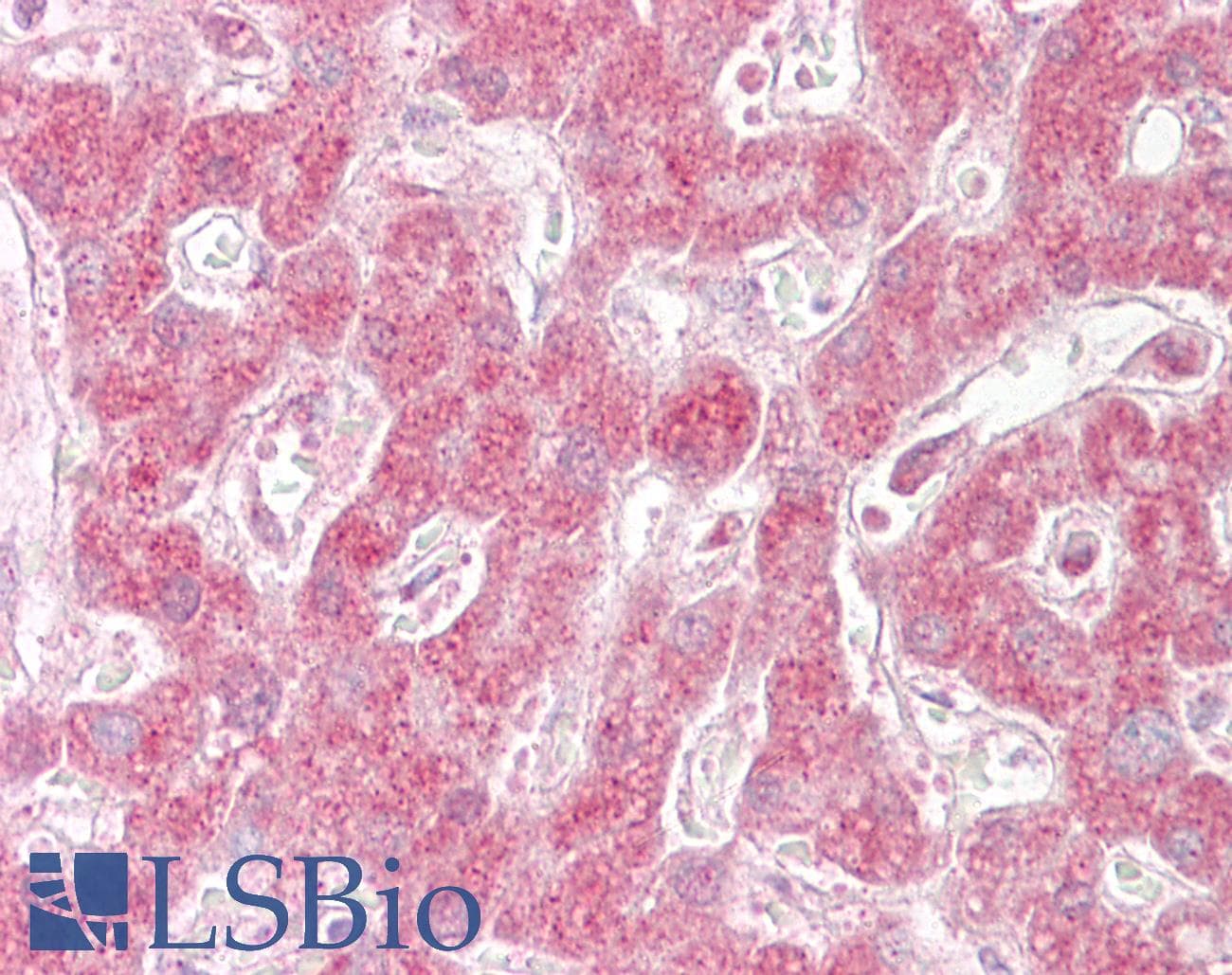 IHC-plus™ MAPKAP1 / MIP1 Antibody (aa100-150)