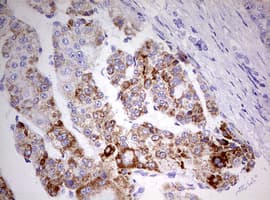 Monoclonal Mouse anti-Human HADH Antibody (clone OTI1E6, aa57-314, IHC, WB)