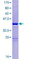 Human ORAOV1 Protein (Recombinant GST)